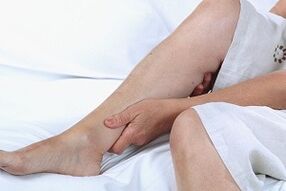 causes et symptômes des varices sur les jambes